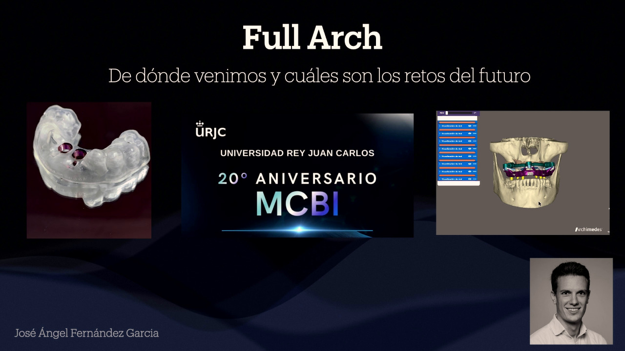 José Ángel Fernández (URJC) -  Full Arch Digital. De dónde venimos y cuáles son los retos del futuro